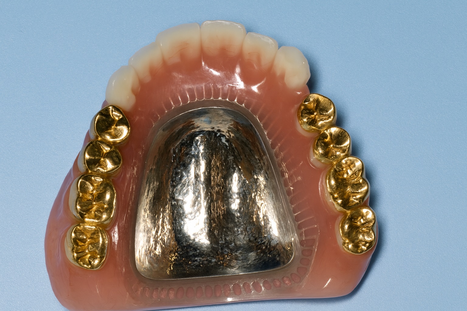 にわ歯科室の20Kメタルオクルーザル総入れ歯