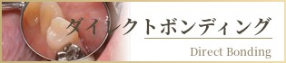 ダイレクトボンディング